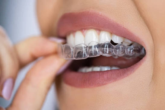 Orthodontics and braces treatment in Kathmandu