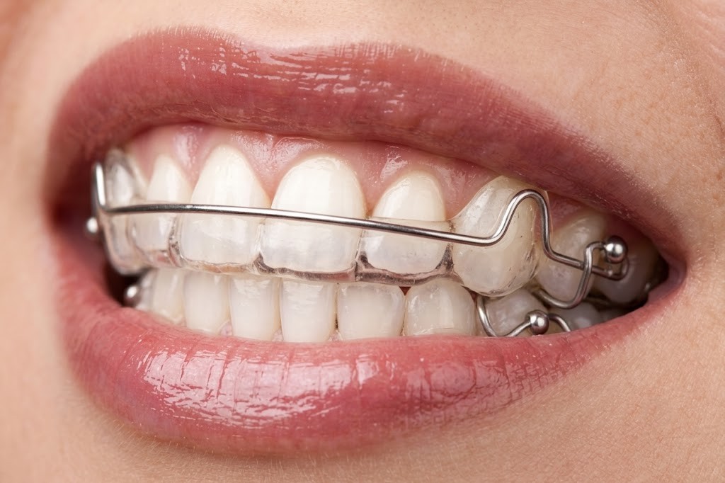 Retainers