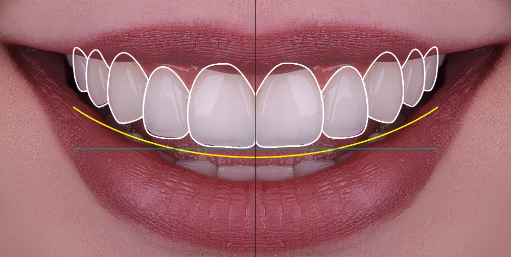 Cosmetic Dentistry and Smile Designing